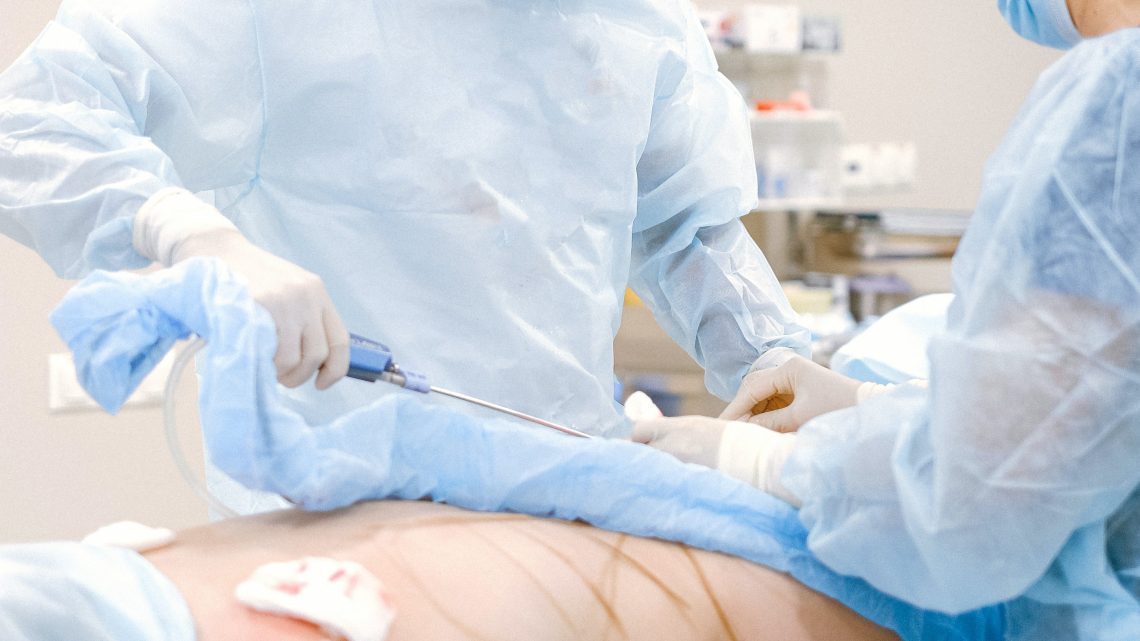 Preguntas frecuentes sobre la abdominoplastia: todo lo que necesitas saber
